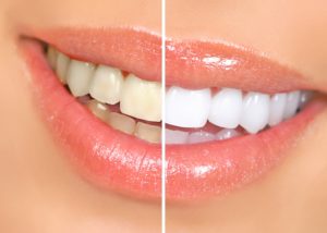 8 Ways to Whiten Your Smile